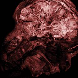 Stages of Decomposition